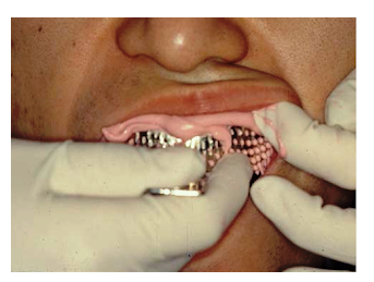 고덕동 치과 구강 스캐너 왜 좋다는 것일까? 관련 이미지 1