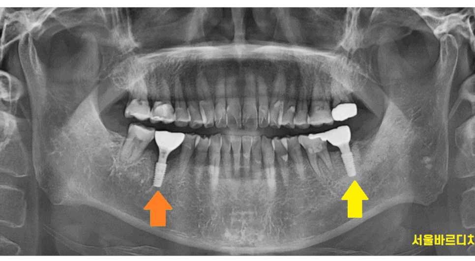 하남 미사 치과 공포증 치료가 두려우신 분들 컴온 관련 이미지 1