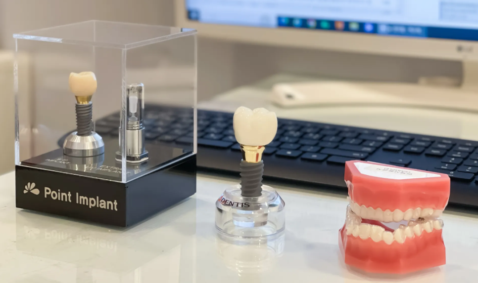 하남 치과 임플란트 질문 폭격기를 환영합니다. 결정은 자유롭게! 관련 이미지 3