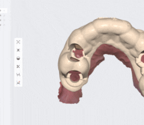 고덕동 임플란트 통증 걱정으로 수술 엄두가 안나시는 분들께 관련 이미지 1