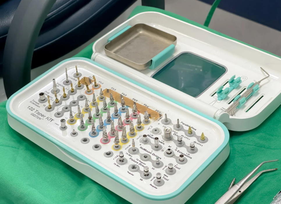 길동 임플란트 내원 횟수 얼마나 와야하나요?? 관련 이미지 6