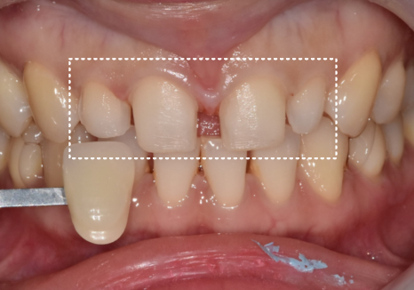 강일동 라미네이트 가격 망설여질 때 꼭 확인해야 할 관련 이미지 5
