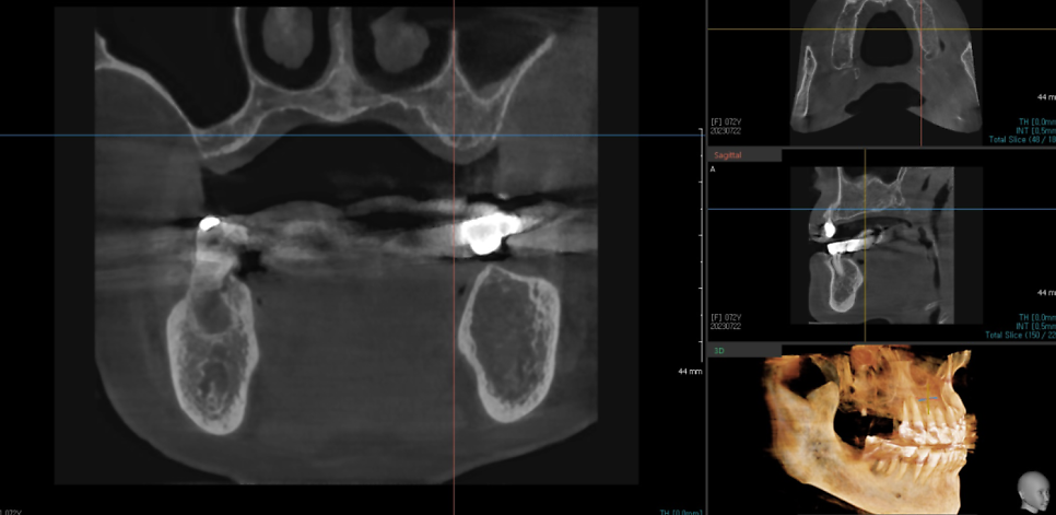 미사역 치과 건강보험 임플란트 혜택이 가능한 병원입니다. 관련 이미지 4