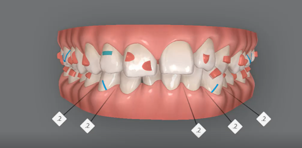 Godeok Station Dental Clinic: If You’re Considering Starting Adult Clear Aligners, Click image 3