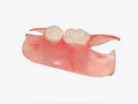 하남 미사 치과 치아 방치하다 올라옴 케이스 보여드립니다. 관련 이미지 8