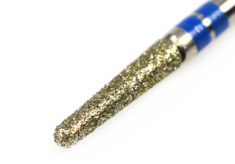 강일역 치과, 검게 보이는 앞니 레진 변색, 무조건 새로 해야 할까요? 관련 이미지 5