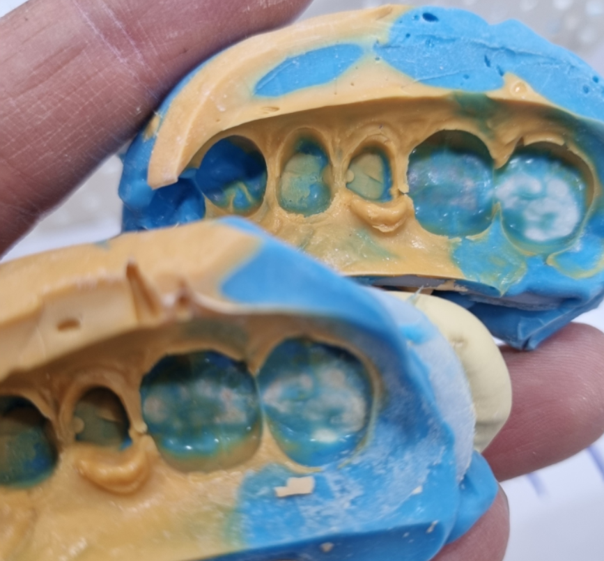 상일동역 임플란트 구강스캐너로 디지털 진료 선두하는 대표 치과입니다! 관련 이미지 2