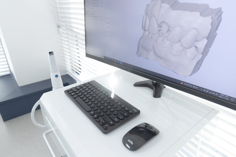 서울바르디치과에서 새로운 3D 구강스캐너, 트리오스를 추가로 도입합니다~ 관련 이미지 2