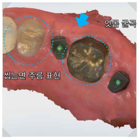 빠진 크라운 크라운 탈락이 알려주는 3가지 신호 관련 이미지 9