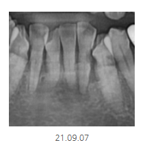 천호동 치과 과잉 진료를 피하는 방법 대공개 관련 이미지 6