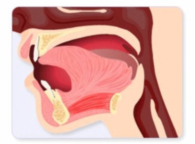 치아교정 재교정 다시 삐뚤어진 치아 원인과 해결방법은? 관련 이미지 2