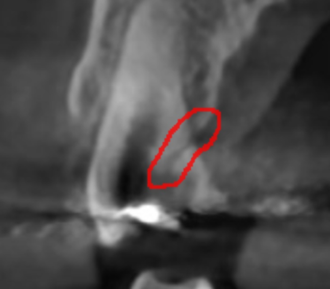 강동 치과 과잉 진료를 피하려면 이것을 확인하세요!! 관련 이미지 5