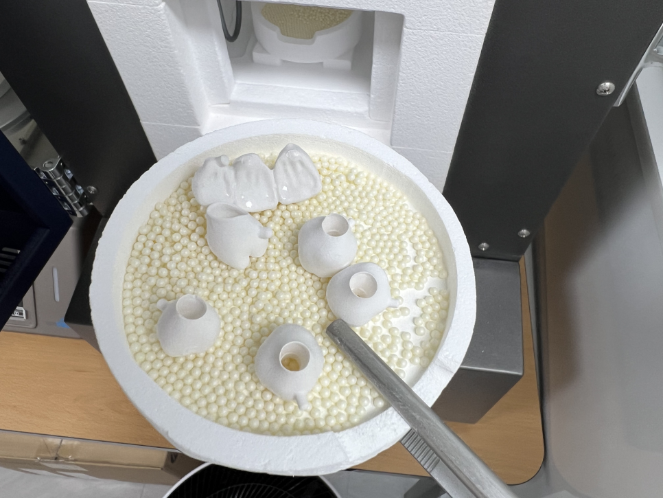 네비게이션 임플란트가 왜 좋다고 그러는거죠? (feat.13가지 장점) 관련 이미지 22