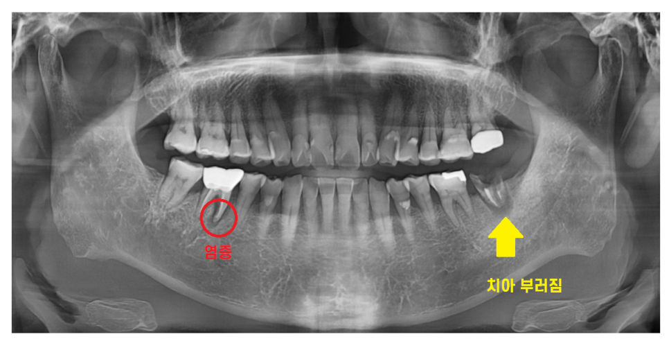 하남 미사 치과 공포증 치료가 두려우신 분들 컴온 관련 이미지 2