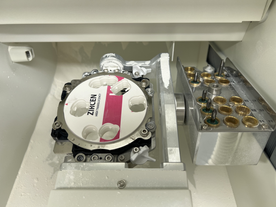 네비게이션 임플란트가 왜 좋다고 그러는거죠? (feat.13가지 장점) 관련 이미지 21