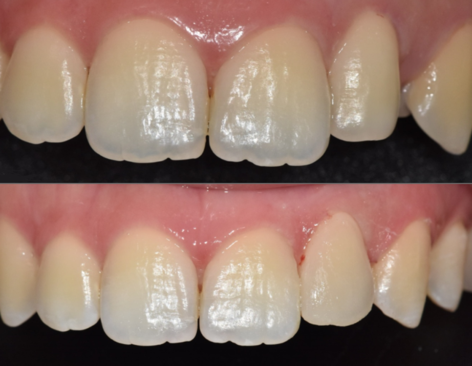강일동 라미네이트 가격 망설여질 때 꼭 확인해야 할 관련 이미지 11