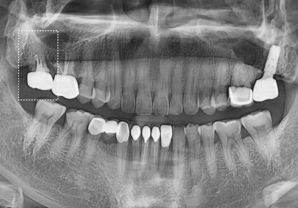 시큰거리는 통증, 시린 이 치약으로 해결 안 된다고요? 관련 이미지 12