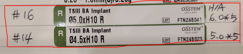 서울 임플란트 병원 선택 전 체크해야할 사항 고민은 이제 그만~ 관련 이미지 6