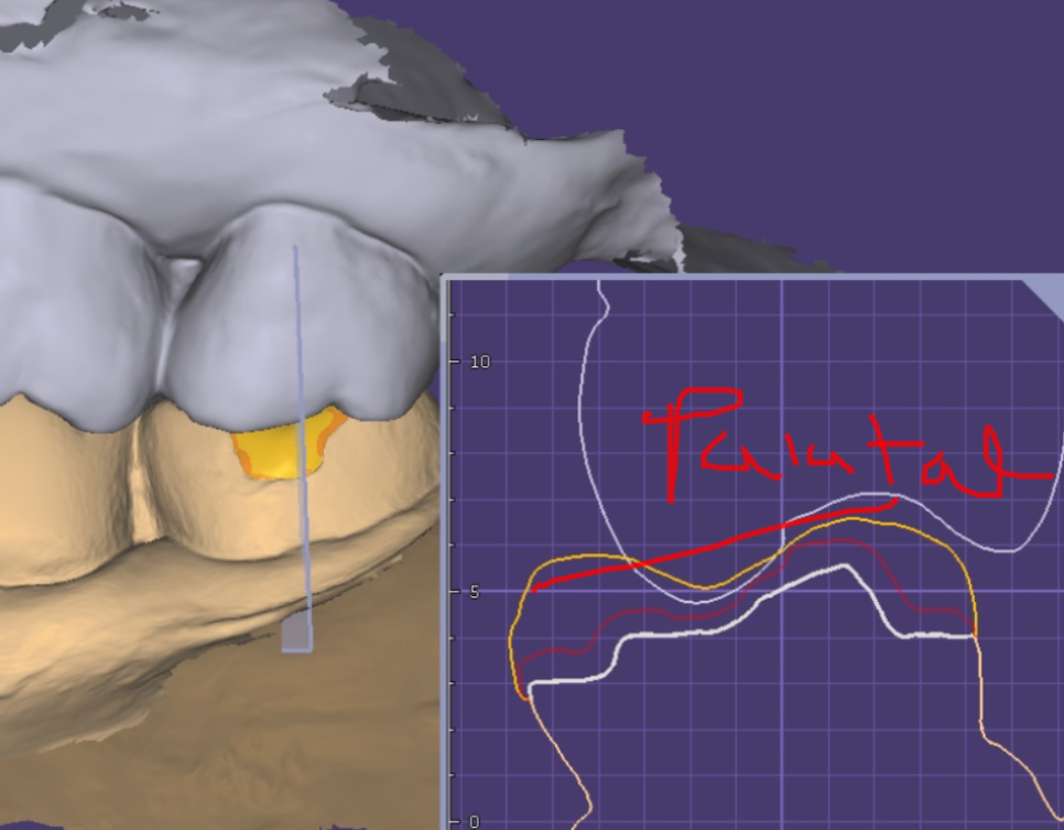 상일동역 임플란트 구강스캐너로 디지털 진료 선두하는 대표 치과입니다! 관련 이미지 8