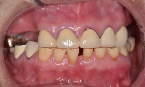 합죽이입 처럼 보이는 이유, 낮아진 관련 이미지 7