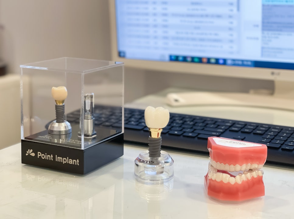 임플란트 1개 가격  무조건 저렴한 임플란트가 좋을까? 관련 이미지 4