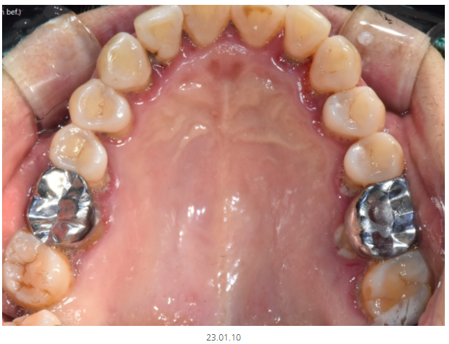 천호동 치과 과잉 진료를 피하는 방법 대공개 관련 이미지 9