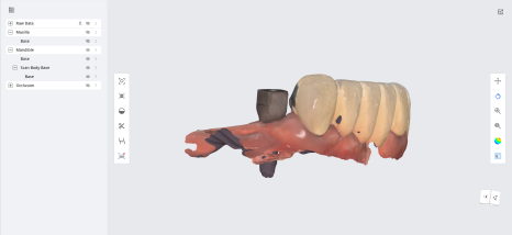 네비게이션 임플란트가 왜 좋다고 그러는거죠? (feat.13가지 장점) 관련 이미지 11