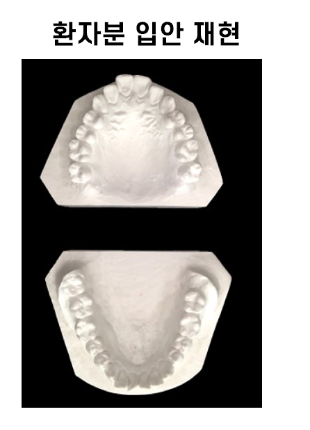 강동구 교정치과 교정 진단비와 관련된 공지 관련 이미지 12
