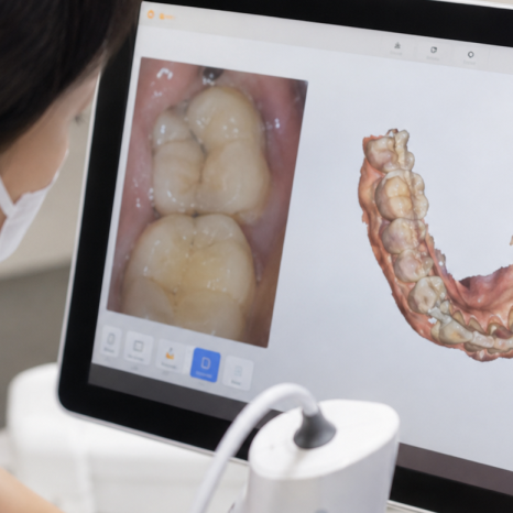 “Taking Impressions” Is Disappearing: What’s Different About Digital Impressions with an Intraoral Scanner? image 3