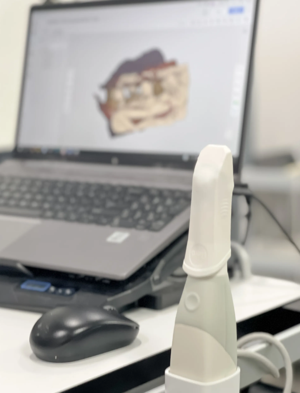 강동역 치과 3000만원의 값어치 구강스캐너를 사용합니다. 관련 이미지 1