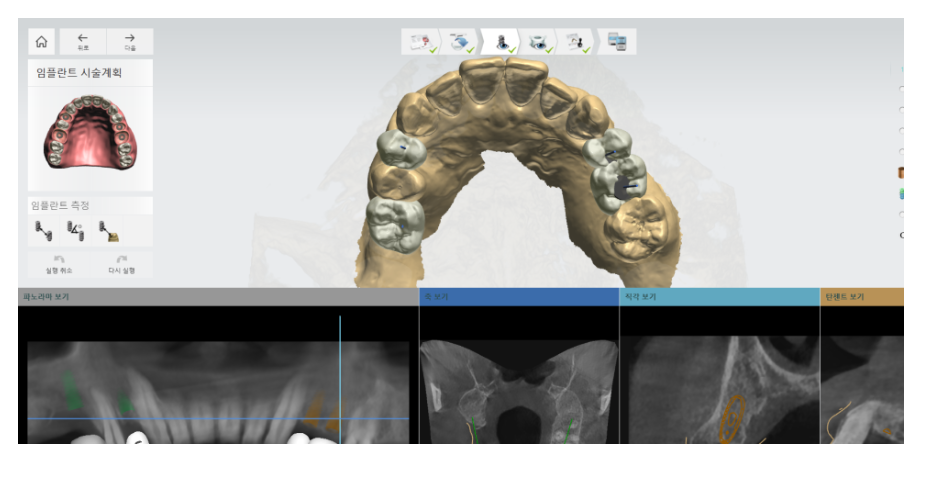 서울 네비게이션 임플란트 치과 불안할 때 좋은 선택지가 될 수 있습니다. 관련 이미지 4