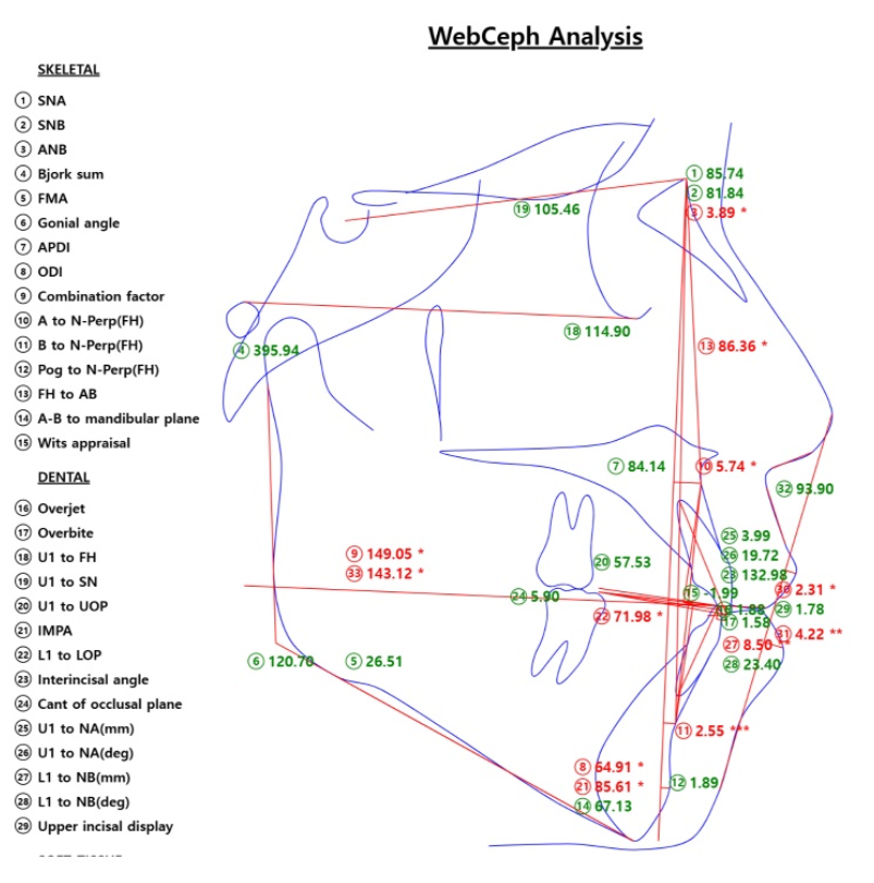 투명교정 치료 과정 이렇게 진행됩니다! 집에서 장치를 받아요! 관련 이미지 2