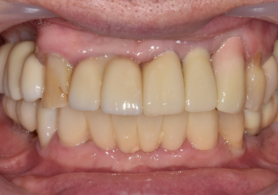 음식물 끼임, 거뭇한 무언가 보인다면? 이미 늦었을 수 있습니다. 관련 이미지 16