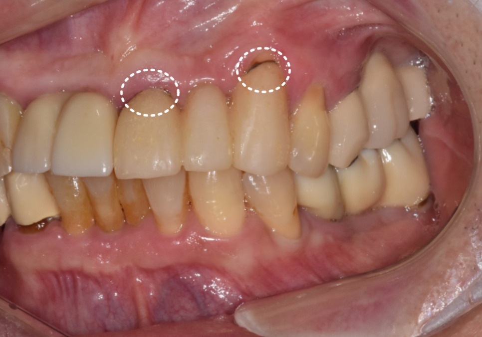 음식물 끼임, 거뭇한 무언가 보인다면? 이미 늦었을 수 있습니다. 관련 이미지 2