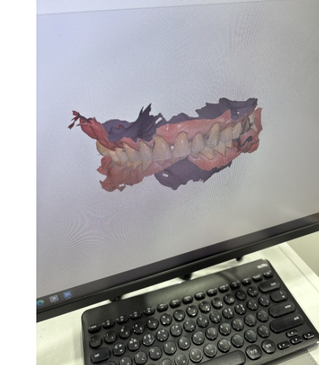 고덕동 치과 구강 스캐너 왜 좋다는 것일까? 관련 이미지 3