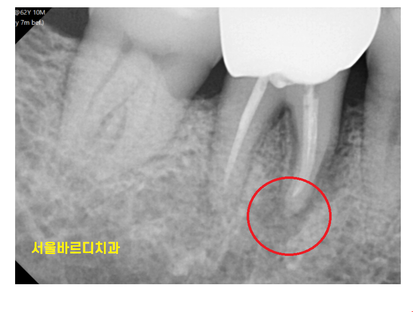 하남 미사 치과 공포증 치료가 두려우신 분들 컴온 관련 이미지 5