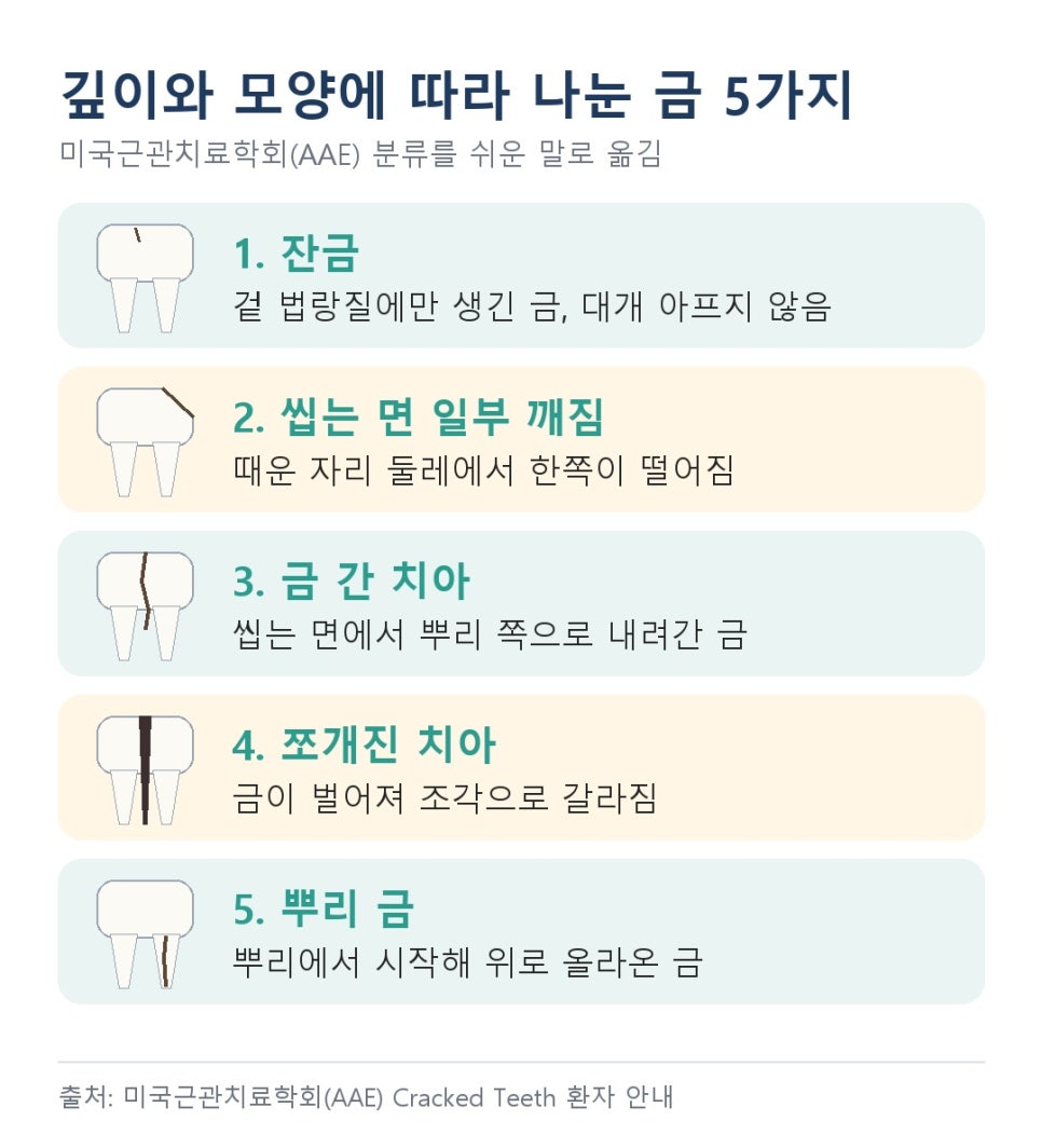 고덕동치과 치아 금 증상, 씹을 때보다 뗄 때 찌릿하면 의심해 보세요 관련 이미지 7
