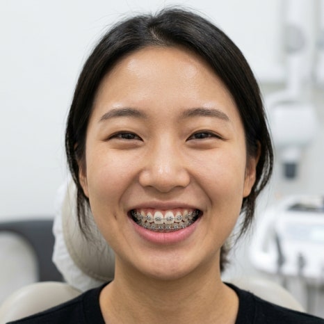 30대 교정, 정말 늦은 걸까요? 관련 이미지 6