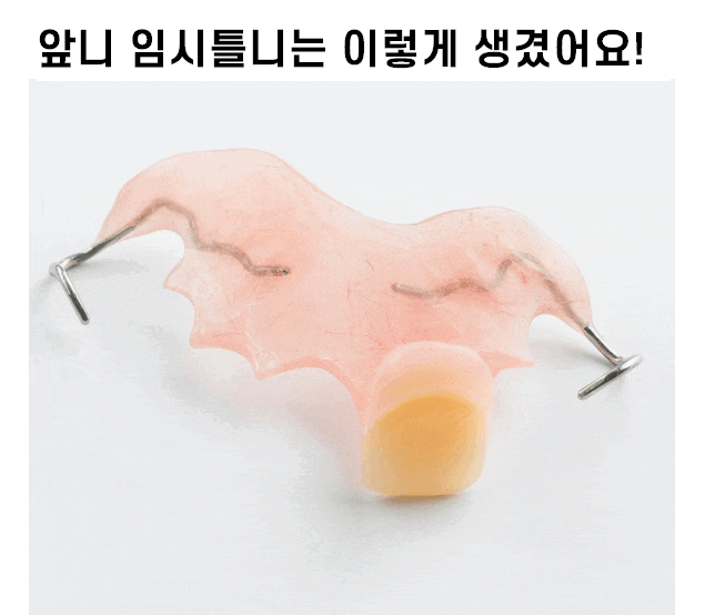 풍산동 임플란트 이 뽑고 임시틀니는 꼭 해야하나요? 플리퍼란? 관련 이미지 1