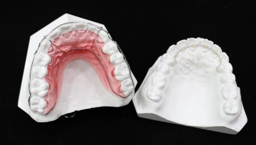 고덕동 치아교정 유지장치는 부정교합 재발을 막기위한 필수입니다! 관련 이미지 5