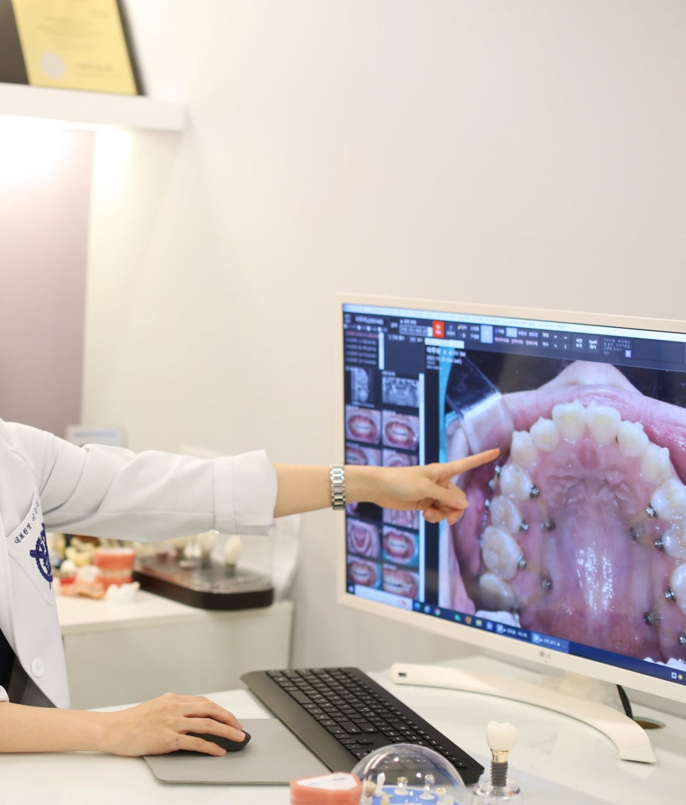 고덕동 치아교정 유지장치는 부정교합 재발을 막기위한 필수입니다! 관련 이미지 6