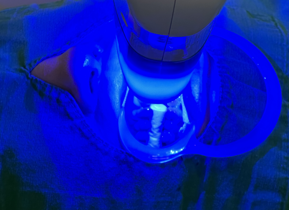 강동구 치아 미백 과정 확인하고 환한 미소로 웃어봐요 우리 관련 이미지 5