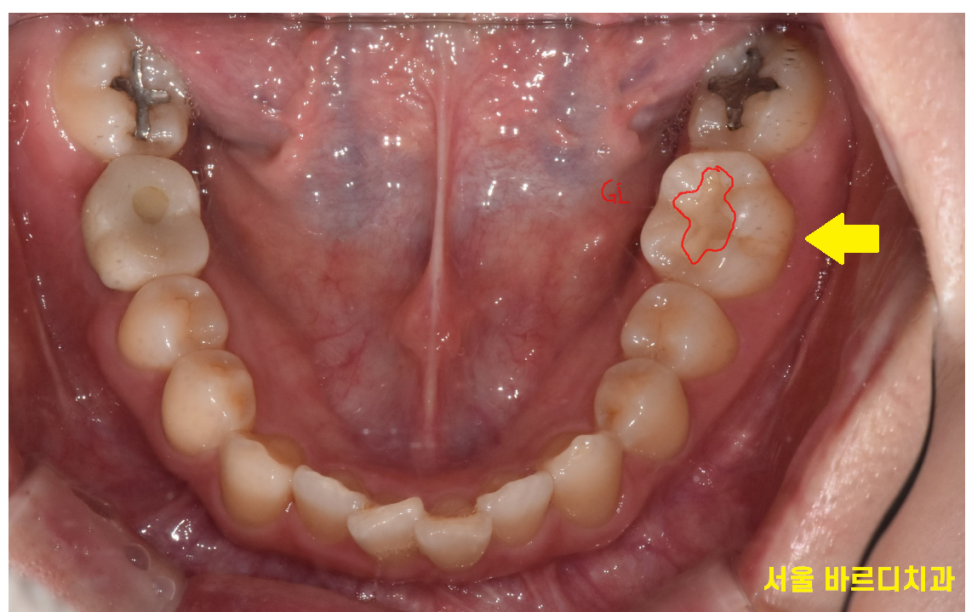 임산부 치과치료 길동 사거리 치과가 알려드립니다. 관련 이미지 2