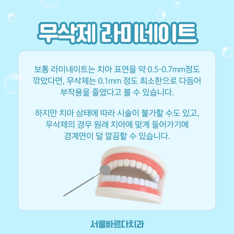 고덕치과 무삭제 라미네이트, 치아를 깍지 않아도 가능하다? 관련 이미지 7