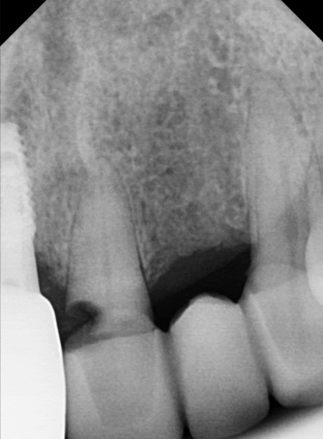 음식물 끼임, 거뭇한 무언가 보인다면? 이미 늦었을 수 있습니다. 관련 이미지 5