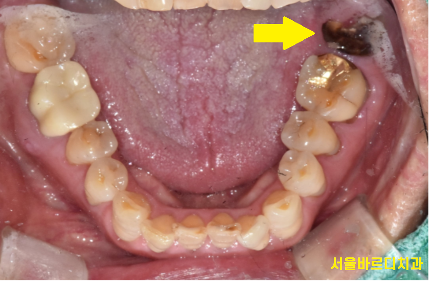 하남 미사 치과 공포증 치료가 두려우신 분들 컴온 관련 이미지 3