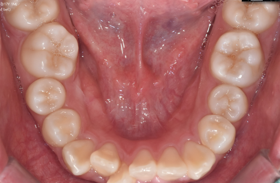 강동구 교정치과 교정 진단비와 관련된 공지 관련 이미지 11