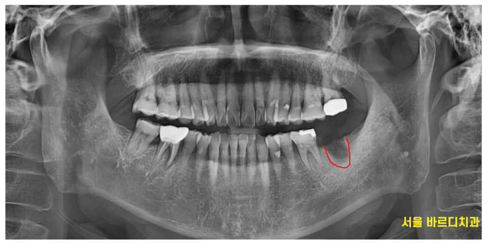 하남 미사 치과 공포증 치료가 두려우신 분들 컴온 관련 이미지 7