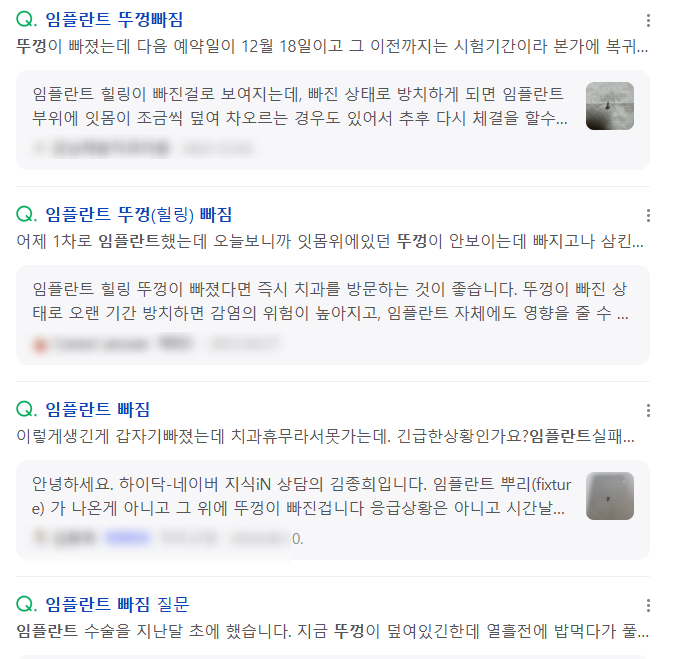 임플란트 뚜껑 빠짐 시공이 잘못된거 아냐? 생각이 들으셨다면 관련 이미지 3