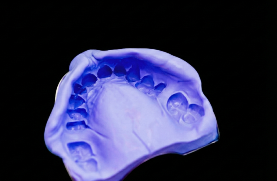 솟구치는 앞니, 흔들리는 치아가 보내는 관련 이미지 12